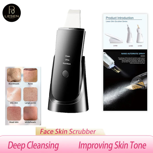 Ultrasonic Skin Scrubber – Blackhead Remover & Facial Lifting Spatula 24kHz