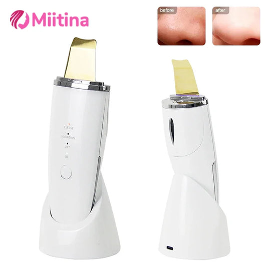 Ultrasonic Skin Scrubber – Blackhead Remover & Sonic Pore Cleanser